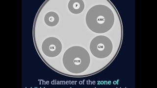 What Does Zone of Inhibition Mean [upl. by Emlynne316]