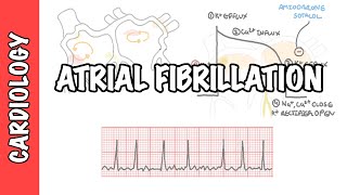 Atrial Fibrillation Overview  ECG types pathophysiology treatment complications [upl. by Orfurd]